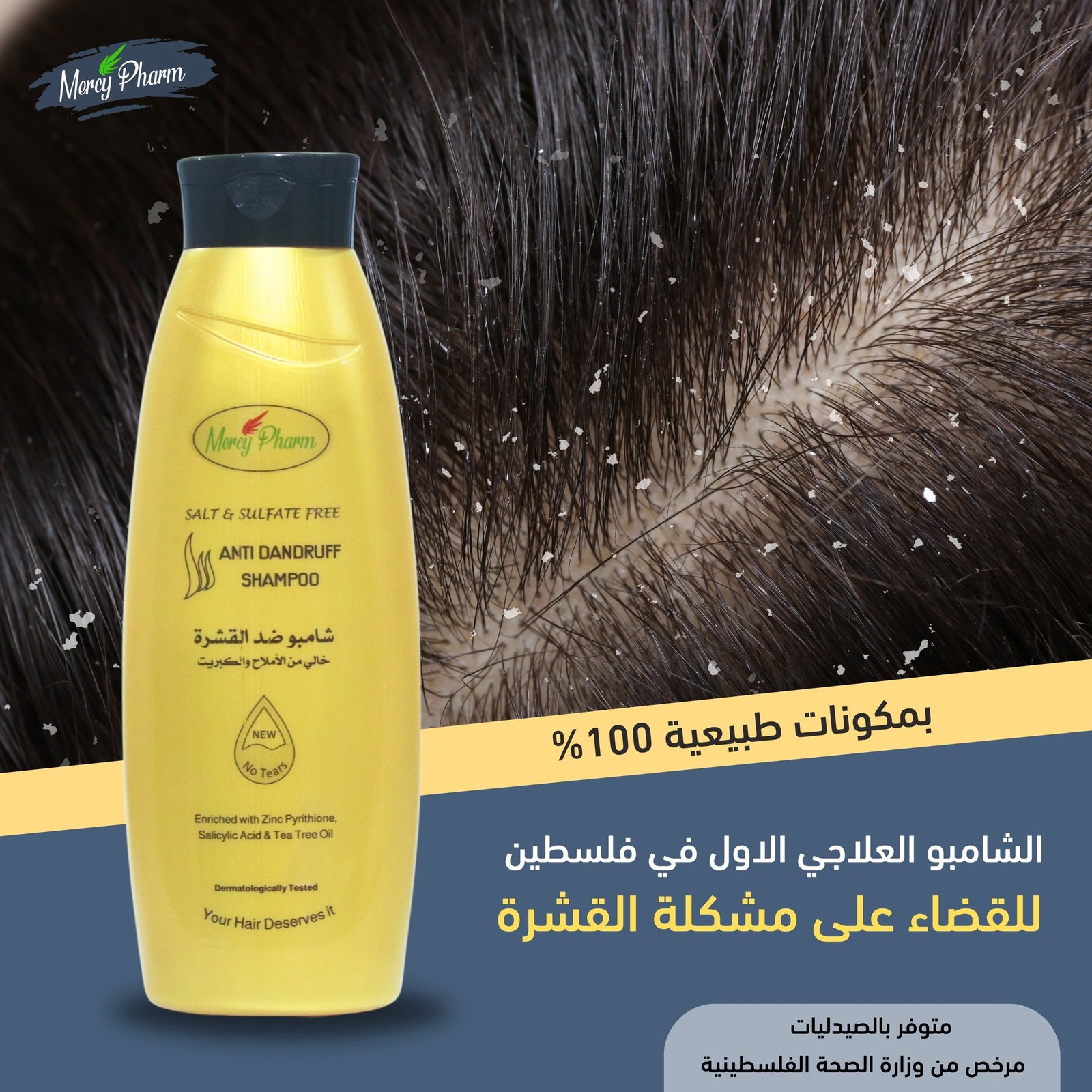 Anti Dandruff Shampoo | Mercy Pharm