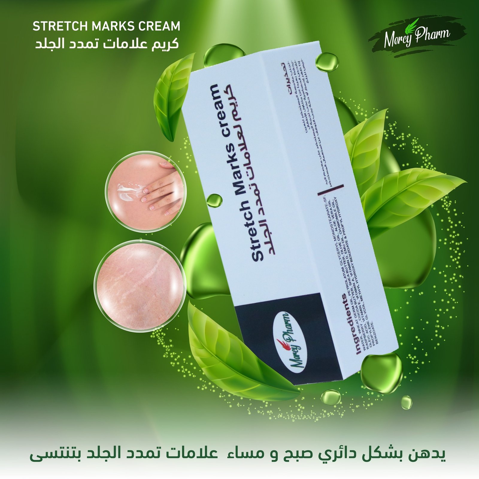 Stretch Marks Cream | Mercy Pharm